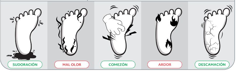 Síntomas del pie de atleta